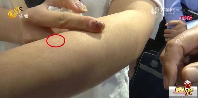 济宁一姑娘“注射减肥”致“皮肤溃烂”代理商转战临沂开加盟大会 四名组织者被警方控制